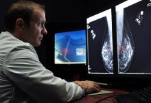 how-ai-is-enhancing-mammogram-accuracy