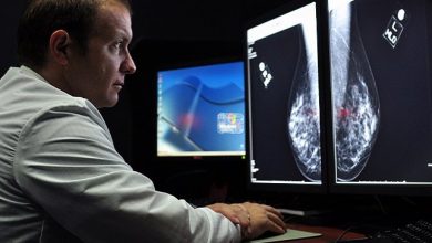 how-ai-is-enhancing-mammogram-accuracy